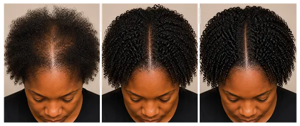 Before-after-hair-care-daily-scalp-wellness-collection